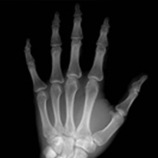 Radiologie générale résoscan