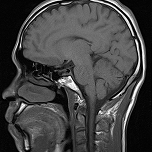 Imagerie par résonance magnétique RésoScan